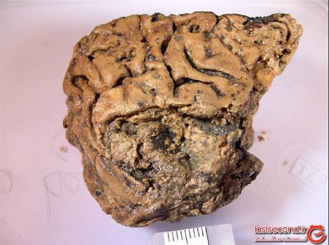 مغز سالم و دست نخورده انسانی 2600 ساله!