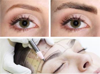 کاشت ابرو چیست و قیمت آن چقدر است؟