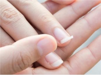 عالی ترین پیشنهاد برای ترمیم طبیعی ناخن های شکسته
