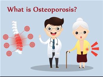 روش های پیشگری و درمان پوکی استخوان، بیماری خاموش