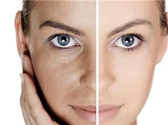 فیلر و بوتاکس چه فرقی دارند و کدام برای شما مناسب تر است؟