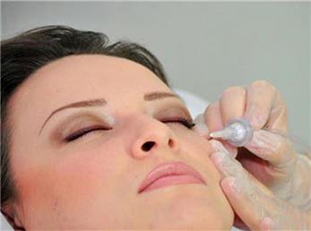 آیا کربوکسی تراپی برای  از بین بردن سیاهی زیر چشم  روش مناسبی است؟