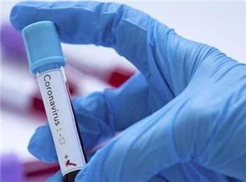 نتایج مطالعه دانشگاه شریف: احتمال مرگ 3/5 میلیون‌ ایرانی از کرونا