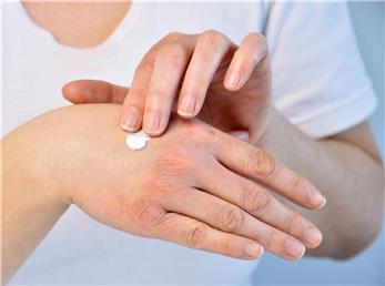 بهترین کرم‌های دست برای پوست خشک