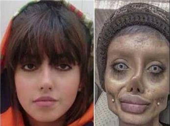 «سحر تبر» در بازداشت به ویروس کرونا مبتلا شد