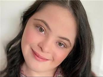 الی گلدشتاین اولین مدل با سندروم داون