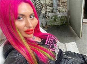 دختر اکراینی دارای عجیب‌ترین صورت پر از تزریق