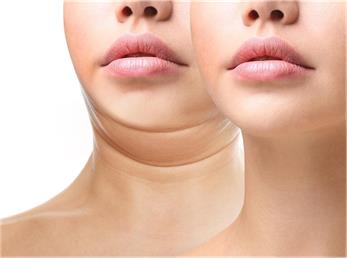 7 ورزش صورت برای رهایی از غبغب