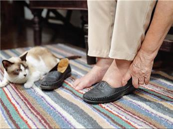 ۳ علامت در پا‌ها که نشانه کبد چرب هستند