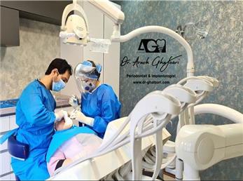 واقعیت هایی که دندانپزشکان در مورد ایمپلنت دندان به شما نمیگویند!!!