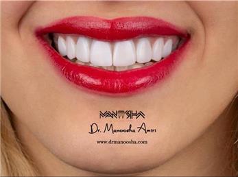 اگر دنبال لبخند زیبا هستید این مطلب را از دست ندهید!!!