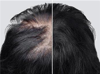 اگر این عادت ها را دارید برای همیشه با موهای خود خداحافظی کنید