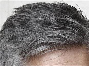 با مصرف این روغن سفیدی مو را از بین ببرید