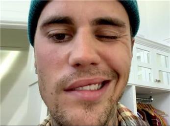 جاستین بیبر خواننده معروف کانادایی و بیماریِ عجیب‌اش!