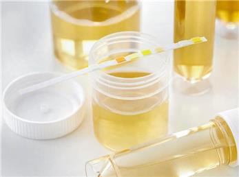 چگونه از رنگ ادرار متوجه بیماری خود می‌شویم؟