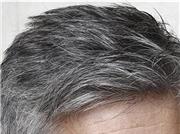 با مصرف این روغن سفیدی مو را از بین ببرید