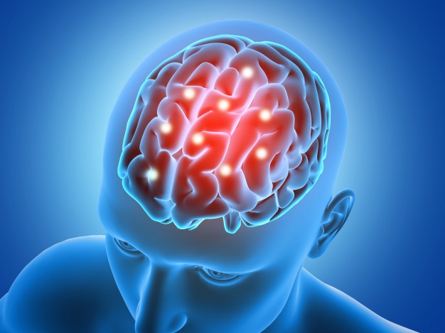 cerebral atherosclerosis