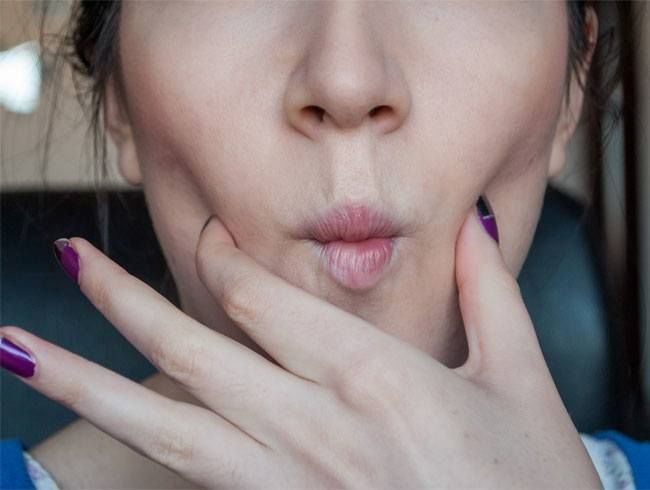 چال گونه بدون جراحی